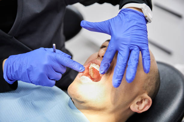 Best Emergency Tooth Extraction in Killen, AL